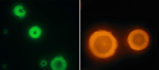 Kreisförmige, gefärbte Bakterien in grün (links) und orange (rechts)