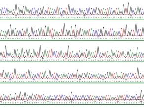 Ausschnitt aus einem Elektropherogramm zeigt die Daten, die mittels automatischer DNA-Sequenzierung gewonnen wurden.