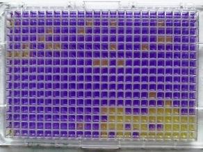 Die gleichmäßig verteilten Felder der Mikrotiterplatte verändern ihre Farbe. Einige sind bereits von Violett auf Gelb umgeschlagen.