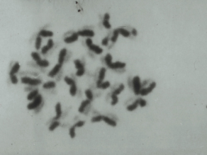 Abbildung der Metaphase-Chromosomen eines Hundsfisches mit erkennbarem Schwesterchromatid-Austausch nach Einwirkung von Malachitgrün.