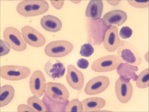 Differentialblutbild einer Bachforelle. Zu sehen sind sowohl rote Blutkörperchen als auch verschiedene Typen weißer Blutzellen.
