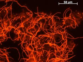 Fluoreszenzmarkierte Fadenbakterien (Microthrix parvicella) in einem Belebtschlamm