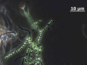 Fadenbakterien (Actinomyceten) mit fluoreszenzmarkierter Enzymaktivität