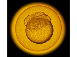 Ein befruchtetes Ei des Zebrabärblings (Danio rerio) durch das Mikroskop betrachtet.