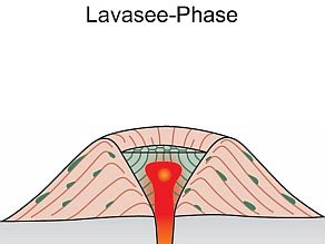 Skizze der Lavasee-Phase (Ein Lavasee im Vulkankrater)