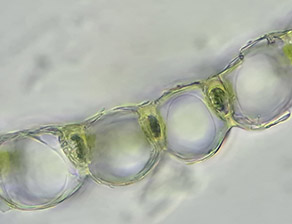 Ein mikroskopisches Foto eines Querschnitts durch ein Torfmoosblatt, bei dem große, farblose Zellen (Hyalocyten) und kleine, grüne Zellen (Chlorocyten) abwechselnd aufeinanderfolgen.