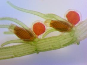 Foto der Fortpflanzungsorgane (Oogonien und Antheridien) der Feinen Armleuchteralge Chara virgata