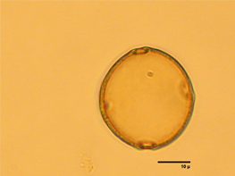 200.000 Jahre alte, fossile Polle des Zürgelbaums (schwarze Linie: 10 Mikrometer = 0,01 Millimeter) 200.000 Jahre alte, fossile Polle des Zürgelbaums (schwarze Linie: 10 Mikrometer = 0,01 Millimeter)