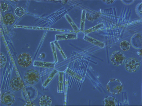 Mikroskopische Aufnahme von verschiedenen Kieselalgen