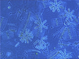 Phytoplanktonaufnahme unter dem Mikroskop mit 100-facher Vergrößerung.