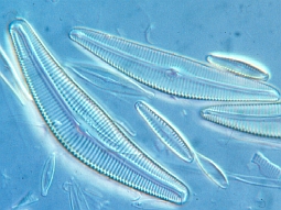 Phytobenthos: mikroskopisches Bild von benthischen Kieselalgen